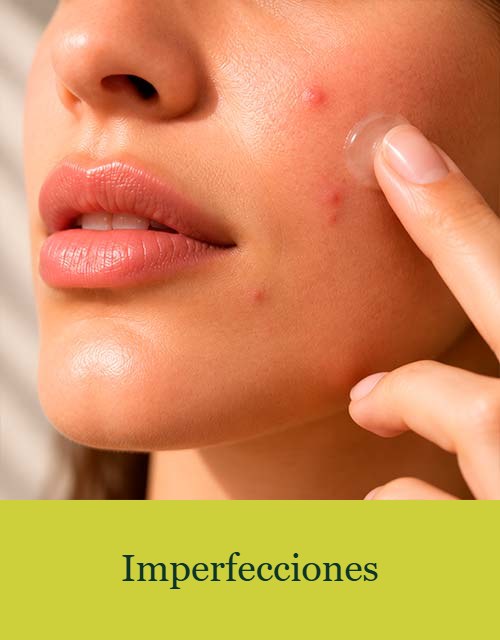 Imperfecciones